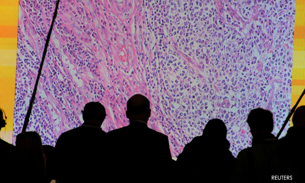 Cancer overtakes heart disease as biggest rich-world killer