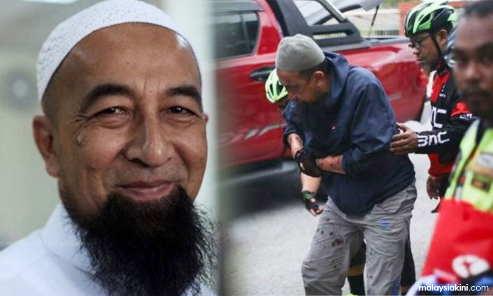 Azhar Idrus jalani pembedahan lengan
