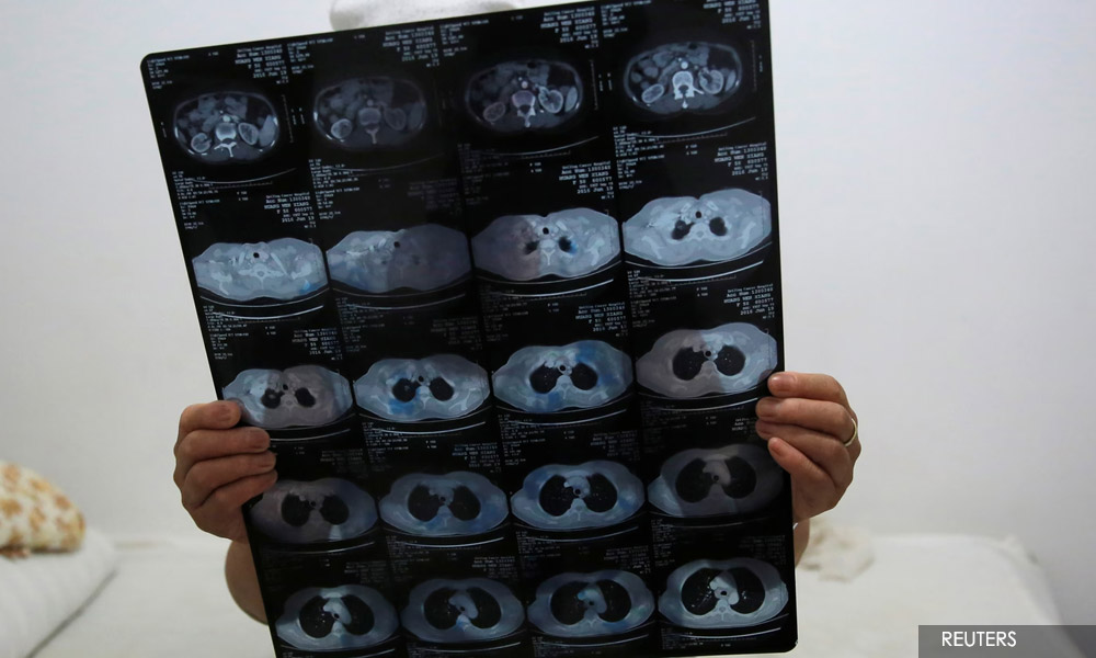 Cancer cases under-reported, says oncologist